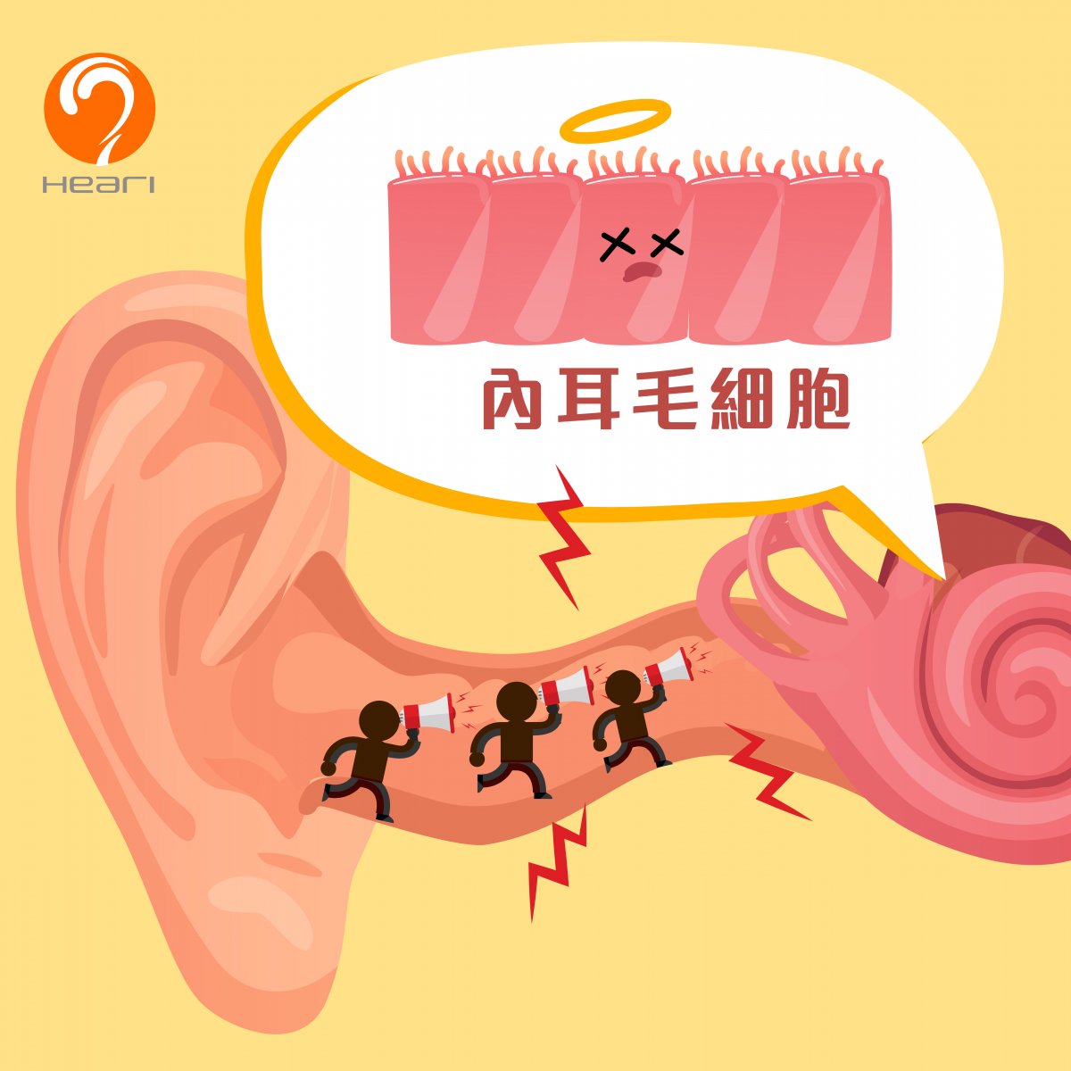 內耳毛細胞 | Heari助聽器