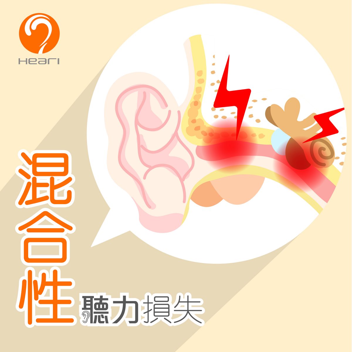 混合性聽力損失 | Heari助聽器